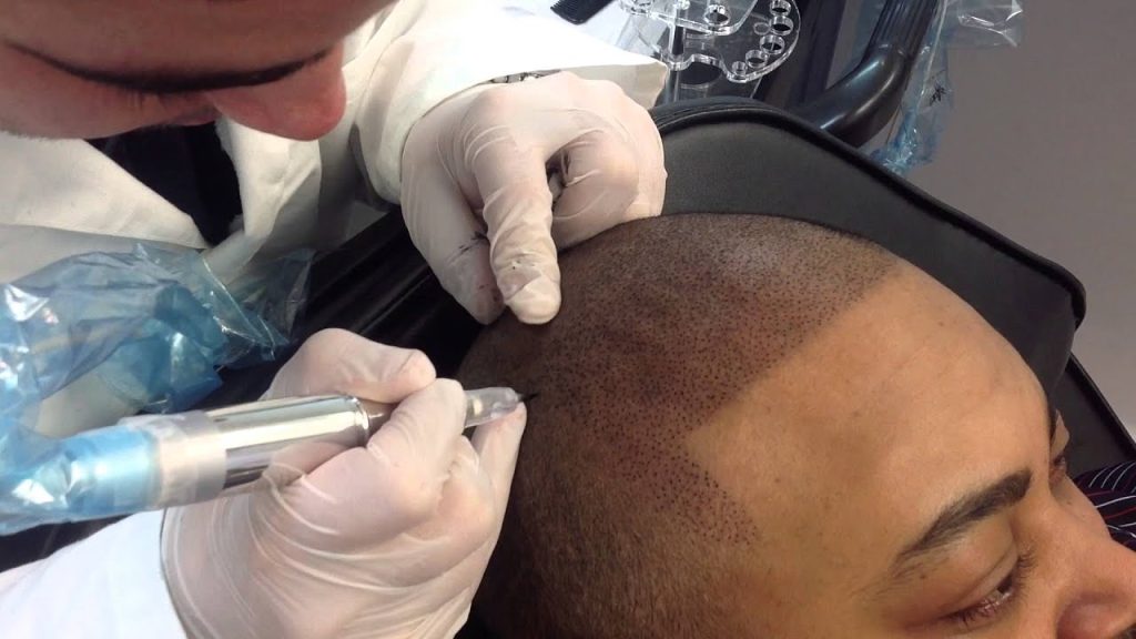 micro pigmentation